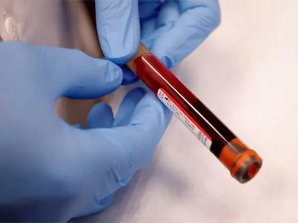 vaccine for colon cancer